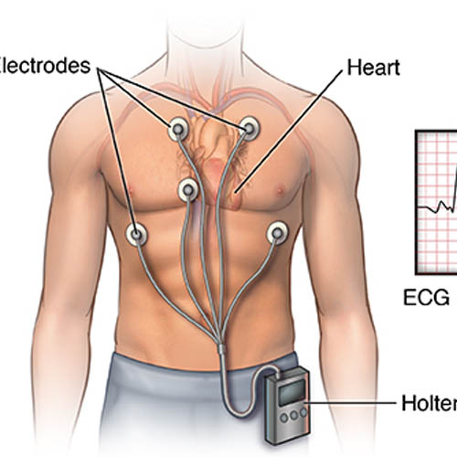 holter-test-in-gurugram